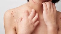 Wounds on children's skin