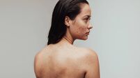 Woman with skin problems